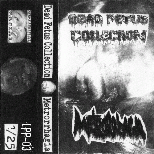 Metrorrhagia : Dead Fetus Collection - Metrorrhagia Metrorrhagia : Dead Fetus Collection - Metrorrhagia